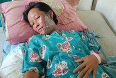 IRT di Seluma Alami Luka Bakar Serius, Diduga Disiram Air Panas oleh Suami