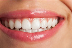 5 Tips Cara Merawat Gigi Agar Tetap Sehat dan Kuat