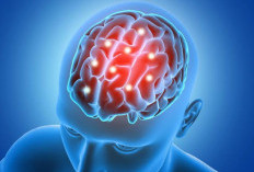 5 Tips untuk Menjaga Kesehatan Otak