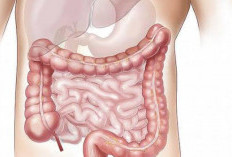 Anda Susah BAB Setiap Hari? Coba Cek Mungkin karena Disebabkan Ini