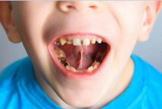 7 Makanan yang Bisa Merusak Gigi, Salah Satunya Buah Jeruk, Benarkah?