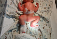 Bayi Ditemukan di Bulog Masih Dirawat Intensif  di Rumah Sakit