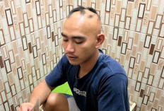Kebotakan Rambut Akibat Stres: Ketika Pikiran Menyerang Mahkota Kepala