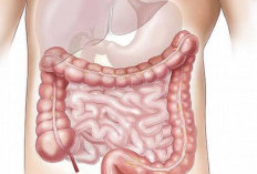 10 Kebiasaan Buruk yang Dapat Sebabkan Usus Buntuk