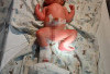 Bayi Ditemukan di Bulog Masih Dirawat Intensif  di Rumah Sakit
